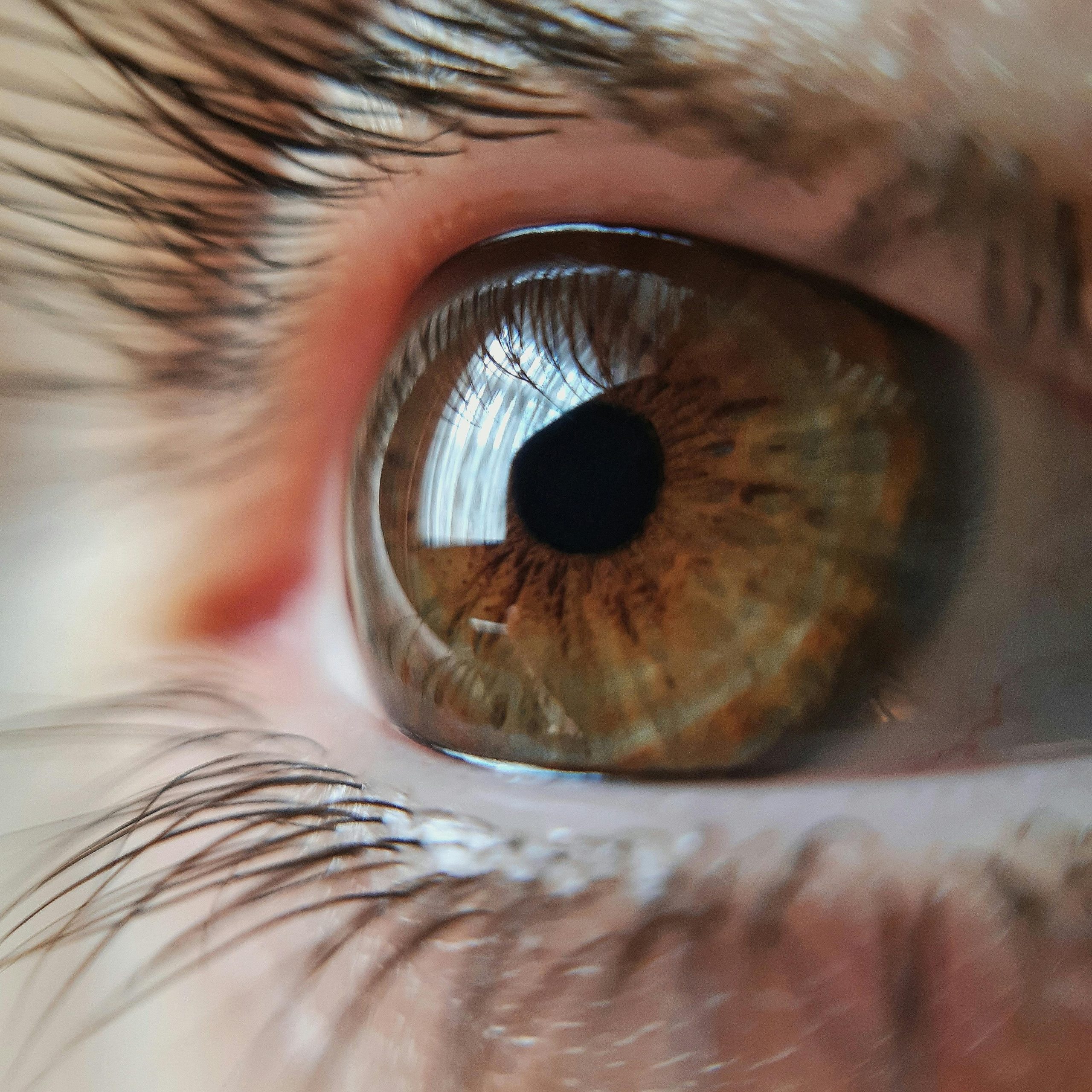A Complete Guide to Transparent Lasik Turkey Price Options
